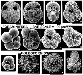Tiny Microfossils Make Up the Sea-Floor Ooze